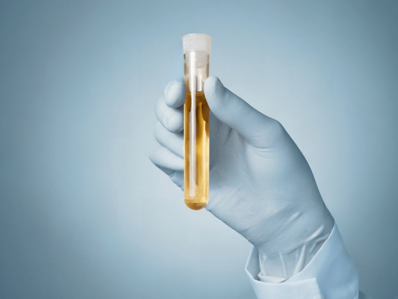 &laquo;&nbsp;Mes cours sentent la pisse&nbsp;&raquo;